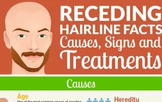 Receding Hairline Causes, Signs and Treatments